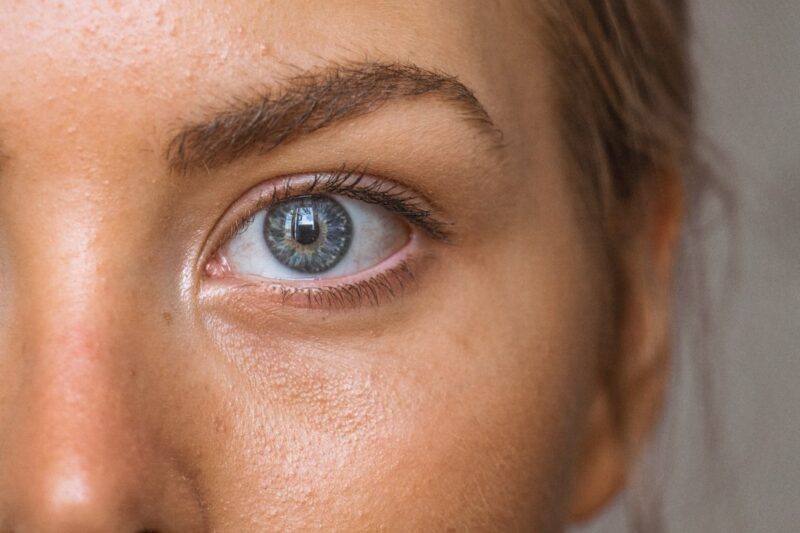 Dealing with Carnosidad en los Ojos: What You Need to Know